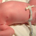 ¿Qué tengo que hacer si quiero guardar el cordón umbilical de mi bebé?