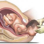 ¿Cuándo tendría que encajarse la cabeza del bebé en mi pelvis?